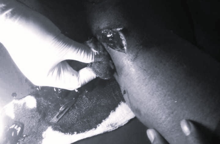 The image shows the victim with severe, deep cuts following the incident. (Photo: Courtesy)